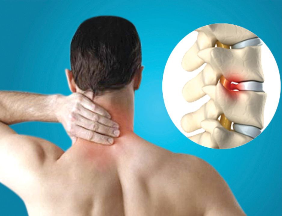 Остеохондроз шейно-грудного отдела симптомы. Остеохондроз шейного отдела. Шейно-грудной остеохондроз симптомы. Остеохондроз грудного отдела позвоночника. Остеохондроз покалывание.